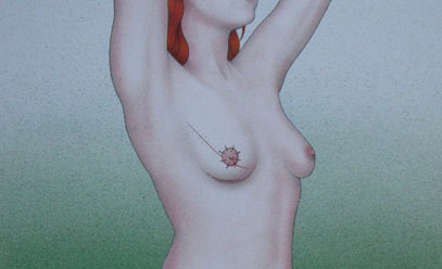 Meme Kanseri Sonrası Meme Rekonstrüksiyonu Meme Kanseri Sonrası Meme Rekonstrüksiyonu