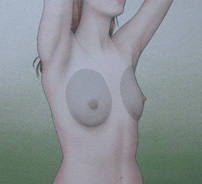 Breast Augmentation Surgery